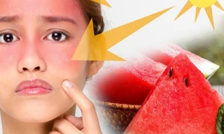 Làm thế nào để bảo vệ làn da xinh trong những ngày nắng nóng cao điểm?