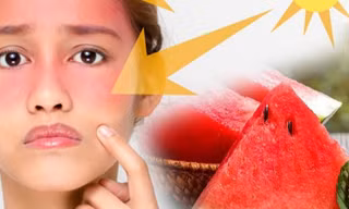 Làm thế nào để bảo vệ làn da xinh trong những ngày nắng nóng cao điểm?