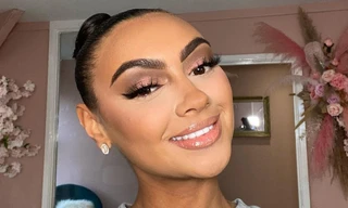 Hoa hậu xứ Wales bị nhiều chấn thương nghiêm trọng sau tai nạn xe hơi 