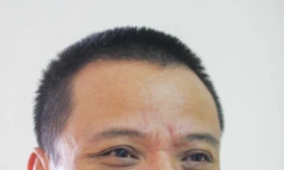 Miền xanh thuở ấy