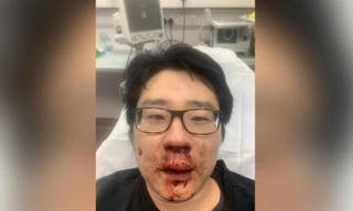 Peng Wang đã bị một nhóm 4 người hành hung 