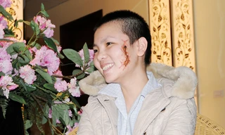 Cô gái bị xăm rết lên mặt muốn làm việc ở bệnh viện