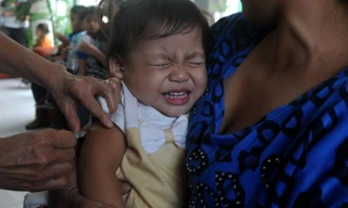 Điều trị sởi cho trẻ em Philippines (Ảnh: CNN)