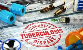 Điều trị bệnh lao bằng ứng dụng điện thoại cho thấy tín hiệu tích cực đối với bệnh nhân