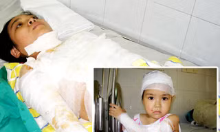 Mẹ và con gái bốn tuổi bị tạt axit