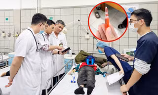 32 học sinh Tiểu học ngộ độc thuốc diệt chuột đang điều trị tại Bệnh viện Bạch Mai