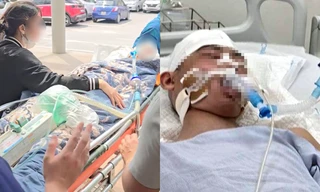 Nam sinh lớp 8 ở Hà Nội bị hành hung đến chấn thương sọ não khi chơi bóng rổ