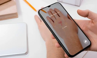 Tính năng mới từ Google cho phép smartphone xác định tình trạng da qua camera