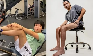 Chi tiền tỷ để kéo dài chân, diện mạo của YouTuber Khoa Pug hiện tại trông thế nào?