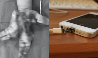 Từ vụ nam sinh 14 tuổi bị thương nặng do nổ điện thoại, cần lưu ý gì để đảm bảo an toàn?