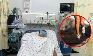 Nam sinh ngất xỉu vì sốc nhiệt, tổn thương gan và thận sau khi chạy thể dục dưới trời nóng