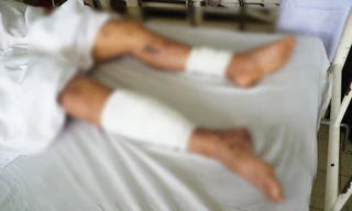 Đắk Lắk: Tự chế pháo nổ tại nhà, 2 nam sinh thương vong 