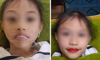 Tranh cãi vụ bé gái 5 tuổi xăm môi, phụ huynh khẳng định: "Từ giờ không phải đánh son"?