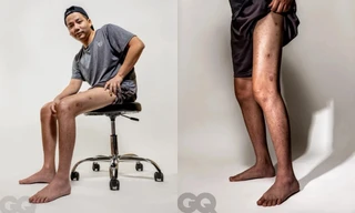 Đôi chân dài trị giá 5 tỷ của Khoa Pug xuất hiện trên fanpage của tạp chí nổi tiếng