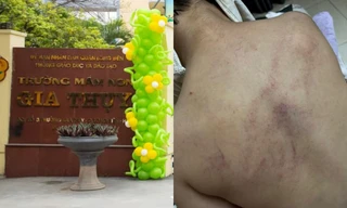 Nghi vấn giáo viên bạo hành trẻ tại trường Mầm non Gia Thụy: Sở GD&ĐT Hà Nội lên tiếng