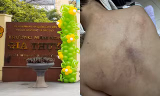 Nghi vấn giáo viên bạo hành trẻ tại trường Mầm non Gia Thụy: Sở GD&ĐT Hà Nội lên tiếng