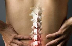 Cách điều trị đau cột sống thắt lưng