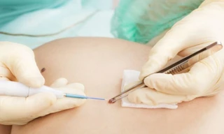 Ảnh minh hoạ: Internet