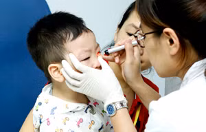 Phẫu thuật miễn phí cho 100 trẻ bị dị tật mắt lác