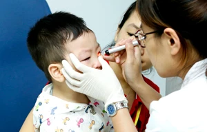 Phẫu thuật miễn phí cho 100 trẻ bị dị tật mắt lác