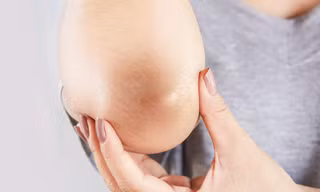 Giúp bạn không cần “cà trắng” những tấm ảnh chụp toàn thân vì đầu gối “đen sì"