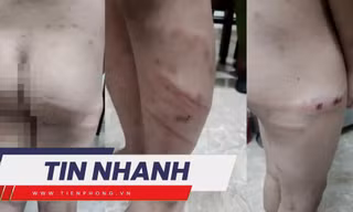 TIN NHANH: Lời khai của nam sinh phao tin lộ đề thi tốt nghiệp THPT; Mẹ bạo hành con trai 11 tuổi nói gì?