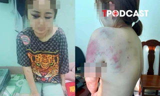 ĐIỂM TIN 28/10: Cô gái bị bạn trai bạo hành 13 tiếng; 'Cô đồng' lừa đảo 28 tỷ đồng