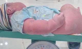 Sản phụ Nghệ An sinh thường con thứ 6 là bé trai nặng 5kg