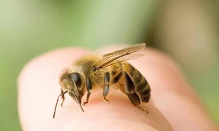 Ra vườn chơi, bé gái 18 tháng tuổi bị đàn ong mật đốt gần 50 nốt