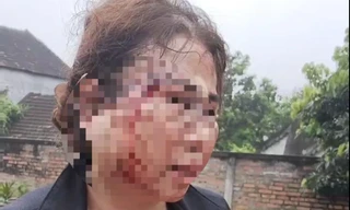 Công an vào cuộc vụ người vợ bị chồng bạo hành nhập viện trước ngày ly hôn