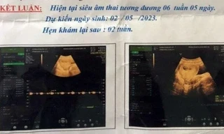 Bắt bảo vệ trường học nghi xâm hại học sinh lớp 6 đến mang thai 