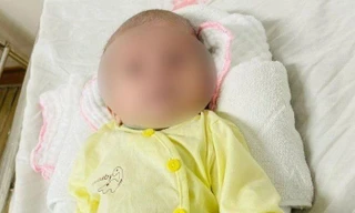 Bé sơ sinh uốn ván nguy kịch vì gia đình dùng kéo tự cắt rốn tại nhà