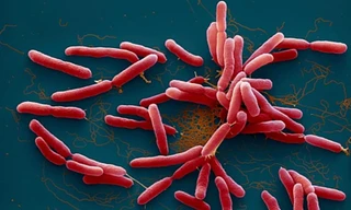 Cứu bé gái 4 tuổi nhiễm 'vi khuẩn ăn thịt người'