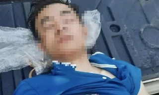 Nghi án một người câm điếc bị đánh dập não bỏ lại trong nghĩa trang 