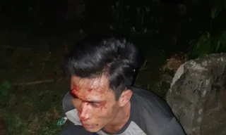 Nhiều công an nguy cơ phơi nhiễm HIV khi vây bắt 'sưa tặc'