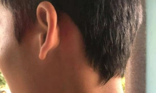 Gia đình cho hay em C. bị đánh vào vùng mang tai, sau gáy và đạp vào bụng