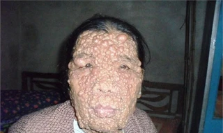 Nỗi khắc khổ trên khuôn mặt bà Đáng