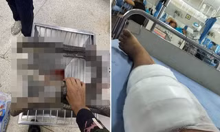 Thái Lan: Người phụ nữ “xử gọn” rắn hổ mang chúa bằng tay không sau khi bị cắn