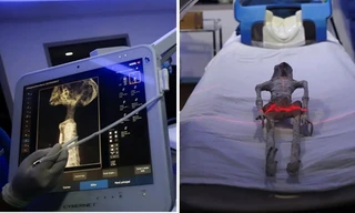 Kiểm tra hóa thạch của “người hành tinh khác” ở Mexico, bác sĩ kết luận thế nào?