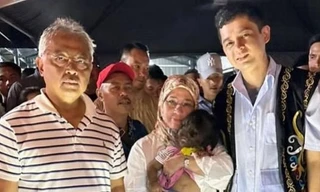 Bé gái mắc hội chứng "người sói" sẽ thành Công chúa vì được Hoàng hậu Malaysia nhận nuôi