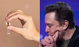 Con chip lần đầu tiên được cấy vào não người của Elon Musk nảy sinh vấn đề