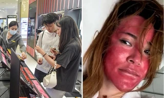 Khuôn mặt của người phụ nữ 22 năm không tẩy trang cho thấy da bị tổn hại thế nào