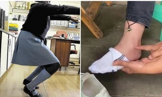 Bị phạt tập squat 150 cái vì giấu đồ ăn vặt, nữ sinh ở Trung Quốc bị thương tật vĩnh viễn