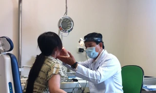 Kỹ thuật mới điều trị ung thư lưỡi