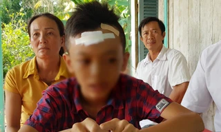 Nam sinh lớp 7 bị bạn đánh chảy máu đầu, ngất xỉu 