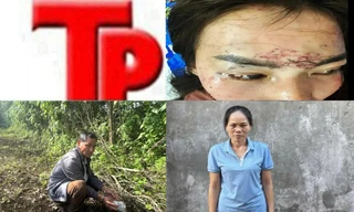 Bản tin Hình sự: Điều tra vụ người phụ nữ bị cướp giật dẫn đến ngã chấn thương sọ não