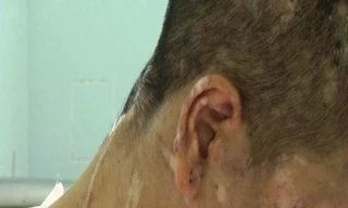 Điều tra vụ nữ giúp việc 9X bị tra tấn đến biến dạng, sảy thai