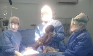 Ca mổ bắt con thành công cho thai phụ mắc COVID-19.