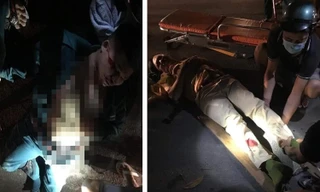 Cán bộ CSGT và dân phòng bị tông gãy chân.