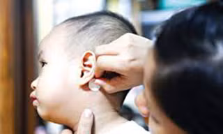 Nguy hiểm khi dùng miếng dán chống say xe cho trẻ.